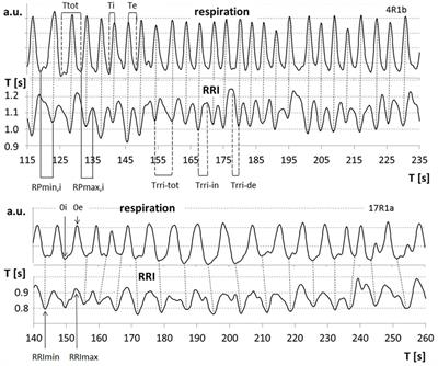 “Switch-Off” of Respiratory Sinus Arrhythmia Can Occur in a Minority of Subjects During Functional Magnetic Resonance Imaging (fMRI)